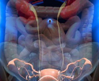 Синдром венозного полнокровия малого таза лечение thumbnail